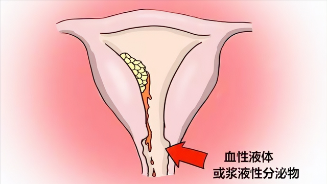 为什么女性下方会有异味?哪些异味要引起注意?医生帮您分析