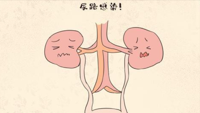 为什么女性下方会有异味?哪些异味要引起注意?医生帮您分析