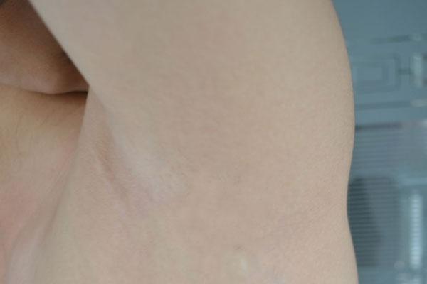 为何有的女人腋毛很长,有的却没有?腋毛真能刮吗?一次性说明白