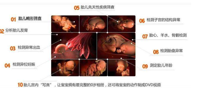 四维彩超约了吗?详解四维彩超全过程,让你放心做产检