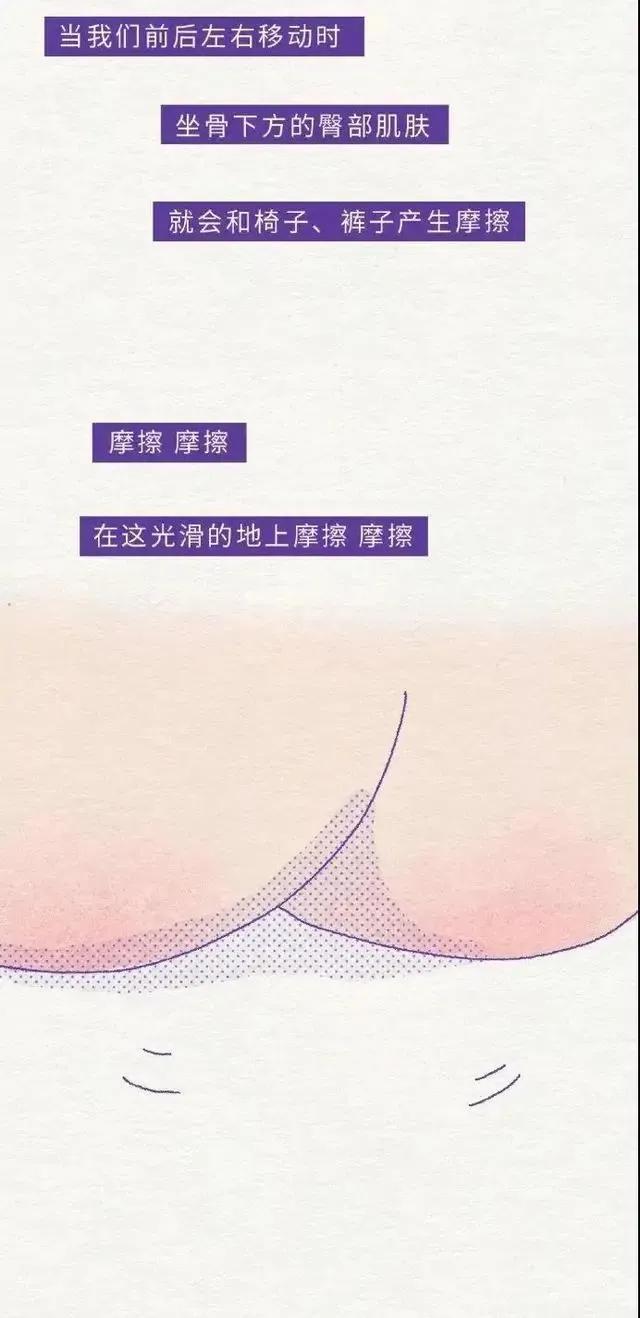女生“屁屁”后面,为啥有黑印子?扒一扒她们的小秘密