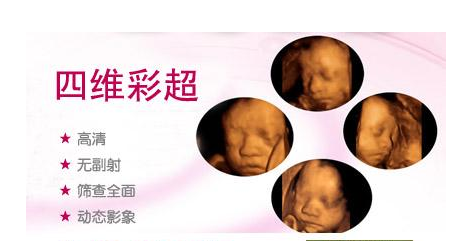 四维彩超约了吗?详解四维彩超全过程,让你放心做产检