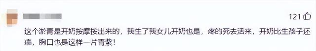 女星开奶胸前被揉致淤青:其实你完全不该受这个罪