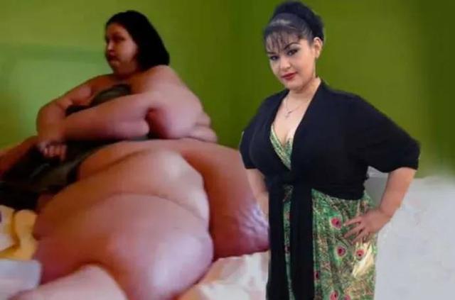 梅拉:世界第一胖,被妹妹陷害遭丈夫抛弃,后狂减800斤实现蜕变
