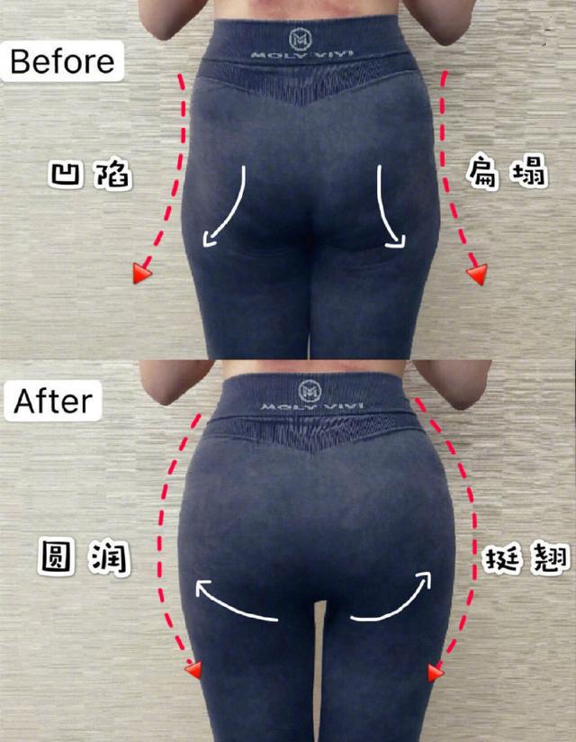 女生常见的5种臀型,哪种臀型最美?看看自己属于哪种