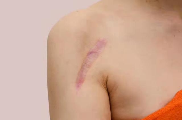 2019年,一位重男轻女的山东父亲家暴10多年,中考前杀害15岁女儿