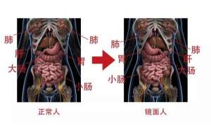 女人左眼跳是好兆头吗(南宁一女子五脏六腑全部反着长，医生：罕见的先天性畸形，发病率约为百万分之一)
