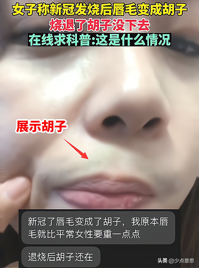 江苏:女子阳后长出来胡子,被怀疑是特效,“我这怎么出门啊”