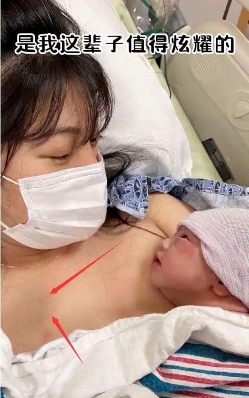 女星开奶胸前被揉致淤青:其实你完全不该受这个罪